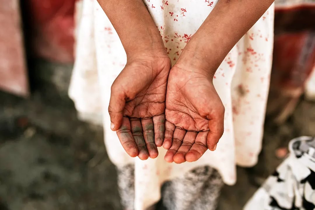 What Percentage of Your Donation Goes to the Work in the Field vs. Overhead Costs?